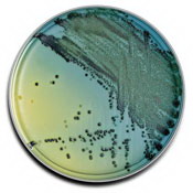 CBC Anaerobe Blood Agar