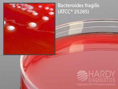 Brucella Agar w/H & K (Anaerobic)