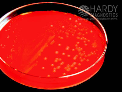 Blood Agar 5%