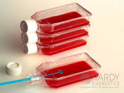 BHI Agar With Blood & Gentamicin