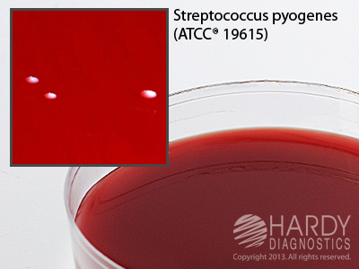 BHI Agar With 5% Sheep Blood, 36mL
