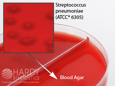 Group A Beta Strep/Blood 5%