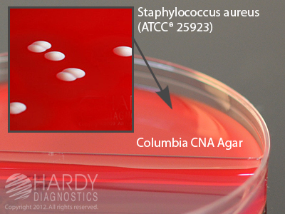 CNA Agar/MacConkey Agar Biplate