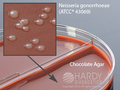 Chocolate/Thayer Martin Biplate