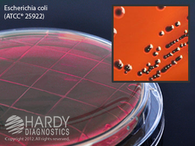 EMB Levine Agar (Eosin Methylene Blue)