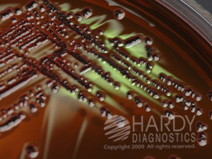 EMB Levine Agar (Eosin Methylene Blue)