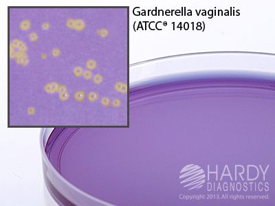 Gardnerella vaginalis Agar