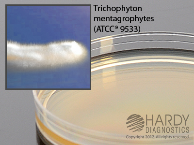 Inhibitory Mold Agar With Gentamicin