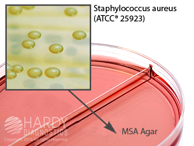 Mannitol Salt/Mannitol Salt Agar