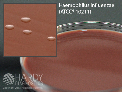 Mueller Hinton Agar w/Chocolate