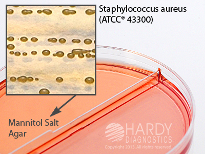 MSA/MSA With Oxacillin