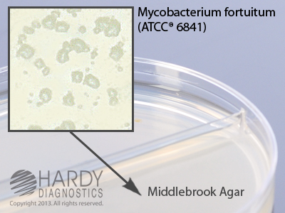 Middlebrook 7H11/7H11 Selective
