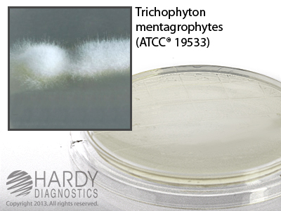 Potato Dextrose Agar (PDA) with Sodium Thiosulfate