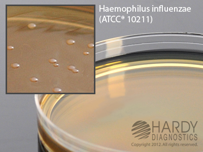 Peptic Digest Agar w/Fildes & Nafcillin