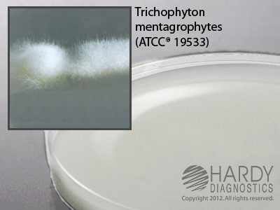 Potato Flake Selective Agar