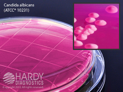 Rose Bengal Agar With Chloramphenicol