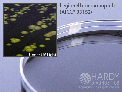 BYCE Selective Agar w/CCVC Antibiotics