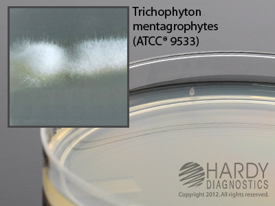 Sabdex With Chloramphenicol & Gentamycin