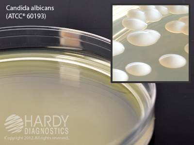 Sabdex Agar With Chloramphenicol & Tetracycline