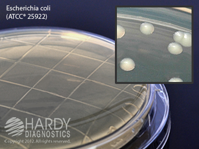 Standard Methods Agar With Lecithin & Tween, 16mL