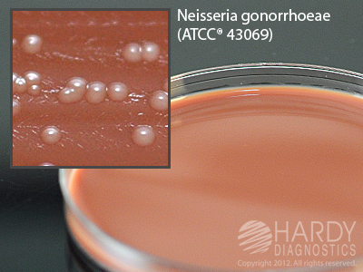 Thayer Martin w/ Vancomycin, Colistin, Nystatin