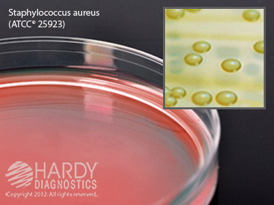 Vogel and Johnson Agar