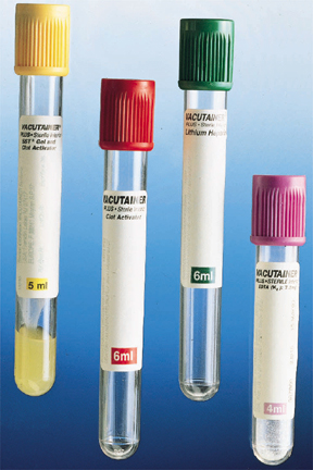 Silicone-Coated Chemistry Tubes: Serum Tube