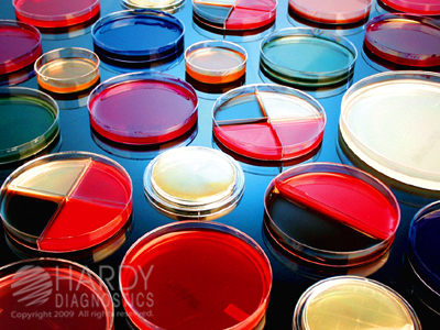 SS Agar Plate