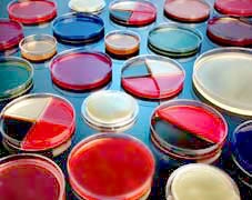 V Agar Plate