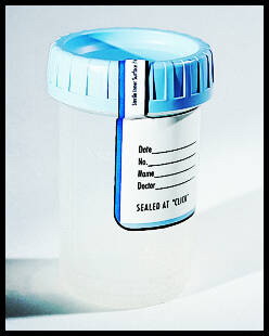 Leakbuster Specimen Container, 12 mL