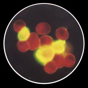 Remel* PathoDx* Respiratory Virus Panel Adenovirus Reagent