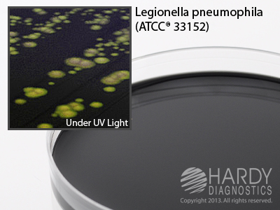 BCYE Agar without Cysteine