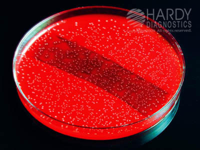 Bovine Blood Agar
