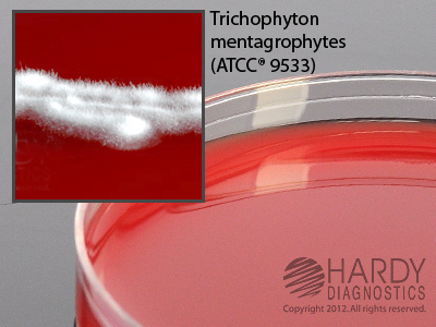 BHI Agar With Blood, Chloramphenicol & Gentamicin