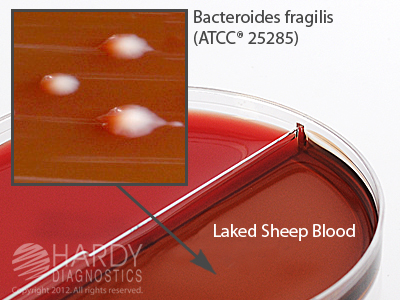Brucella Agar With Hemin & Vitamin K /LKV