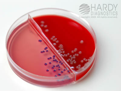 BluEcoli� Urine Biplate