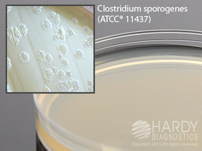 Egg Yolk Agar, Modified