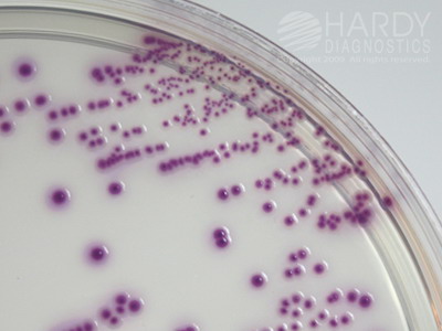 HardyCHROM� ECC, for E. coli and coliforms, 15x60mm contact plate