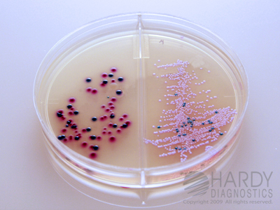 HardyCHROM™ Urine Biplate (HUrBi™)