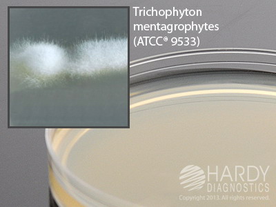 Inhibitory Mold Agar