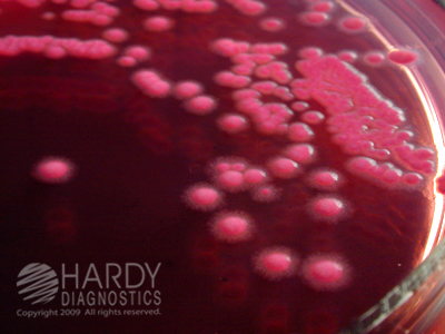 MacConkey Agar, 15x100mm plate