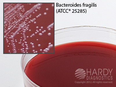 Neomycin Anaerob Blood Agar