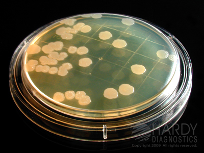 D/E Neutralizing Agar 15x60mm