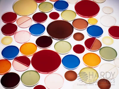 Osmophilic Yeast Agar