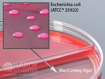 Rose Agar/MacConkey Agar