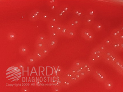 Selective Strep Agar