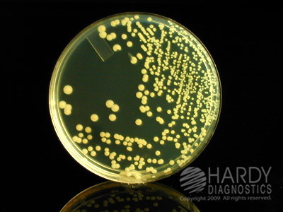 TSA (Tryptic Soy Agar)