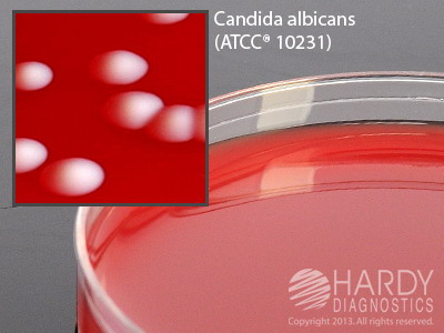 Tryptic Soy Agar (TSA) with Sheep Blood 5% and Chloramphenicol