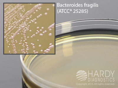 Wilkins-Chalgren Agar