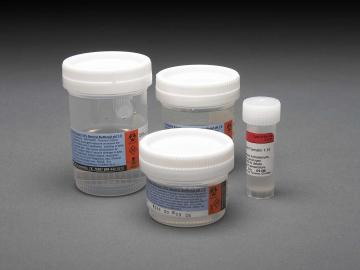 Prefilled Neutral Buffered Formalin, 1 Liter